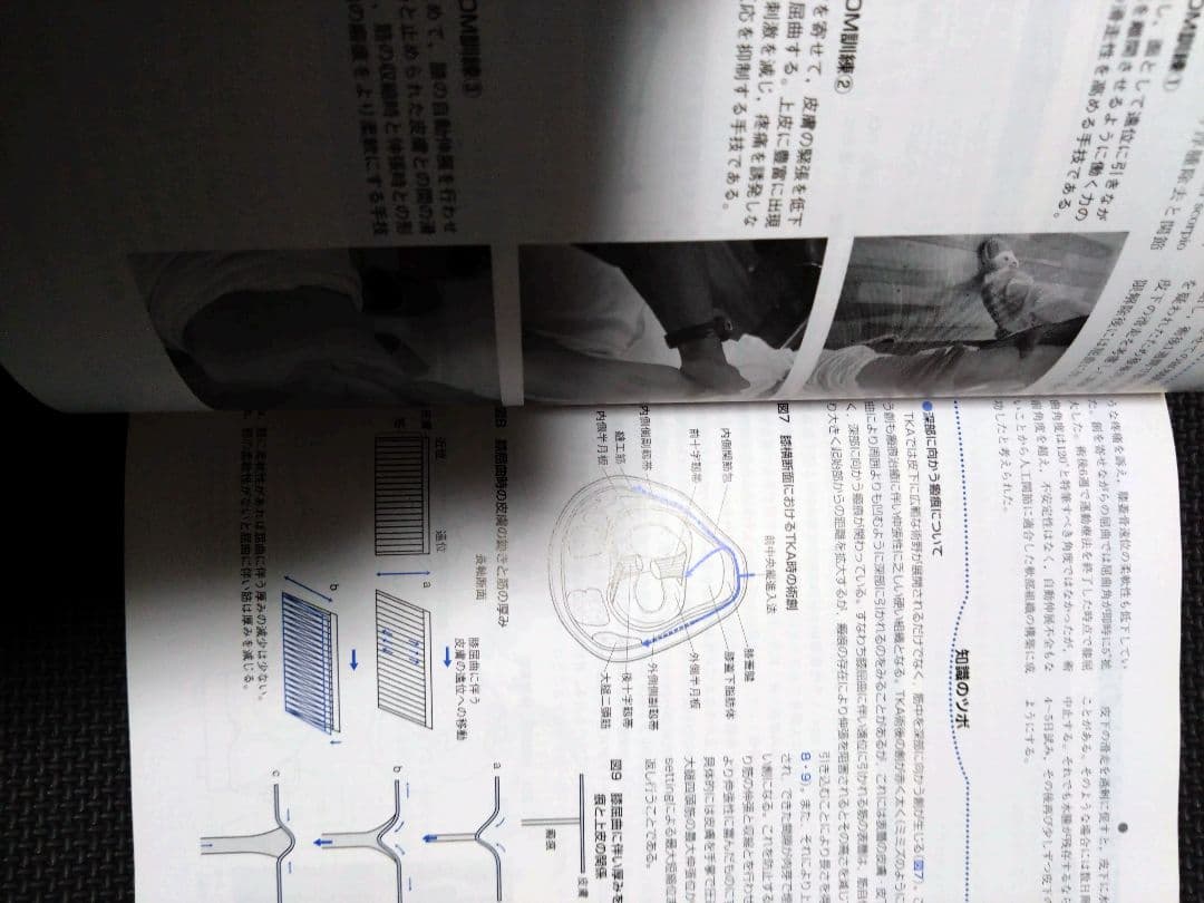 整形外科運動療法ナビゲーション　関節機能解剖学に基づく 下肢体幹　理学療法　PT