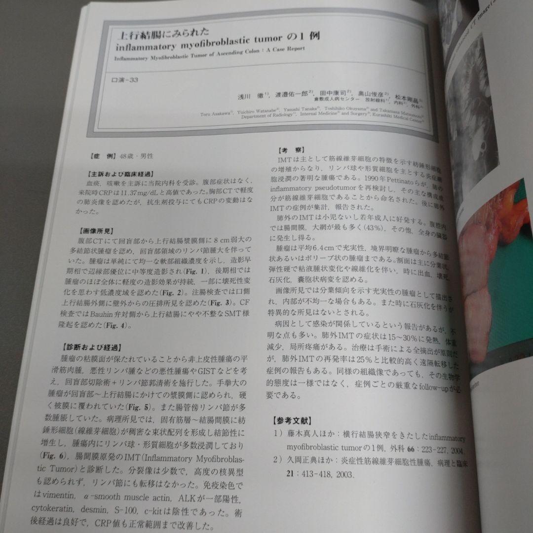 腹部画像診断アトラスⅫ