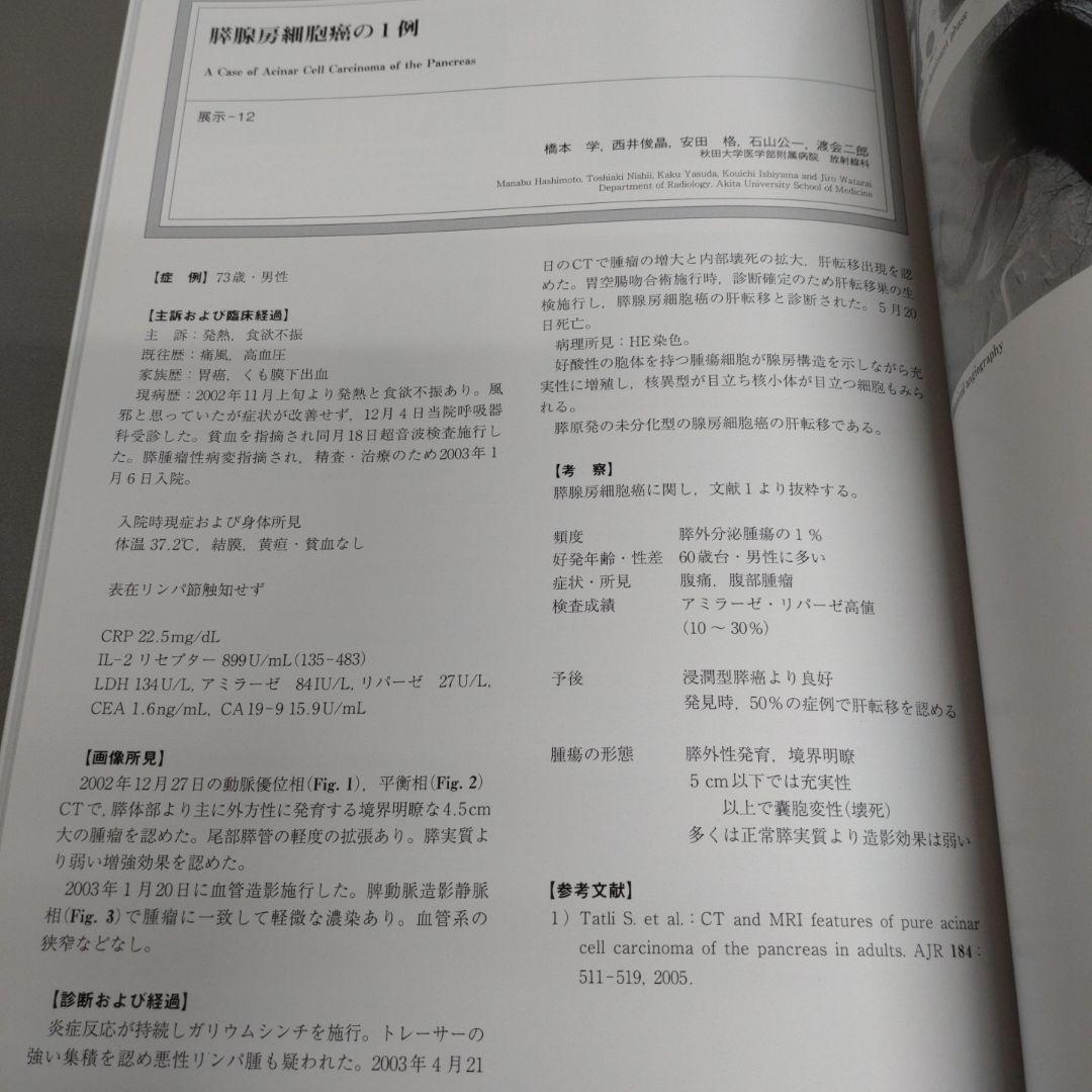 腹部画像診断アトラスⅫ