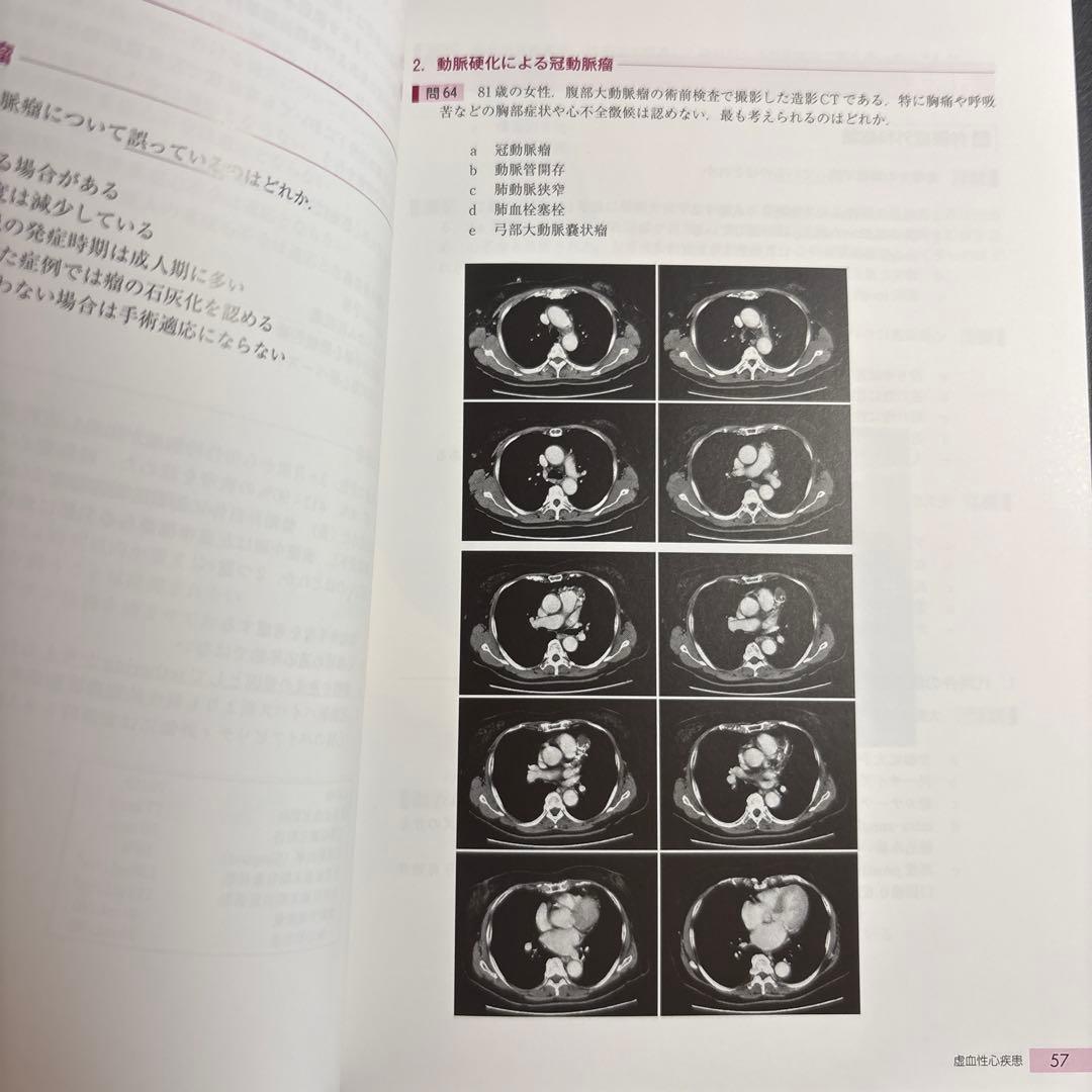 心臓血管外科 専門医認定試験 2016～2020 [問題編・解説編]