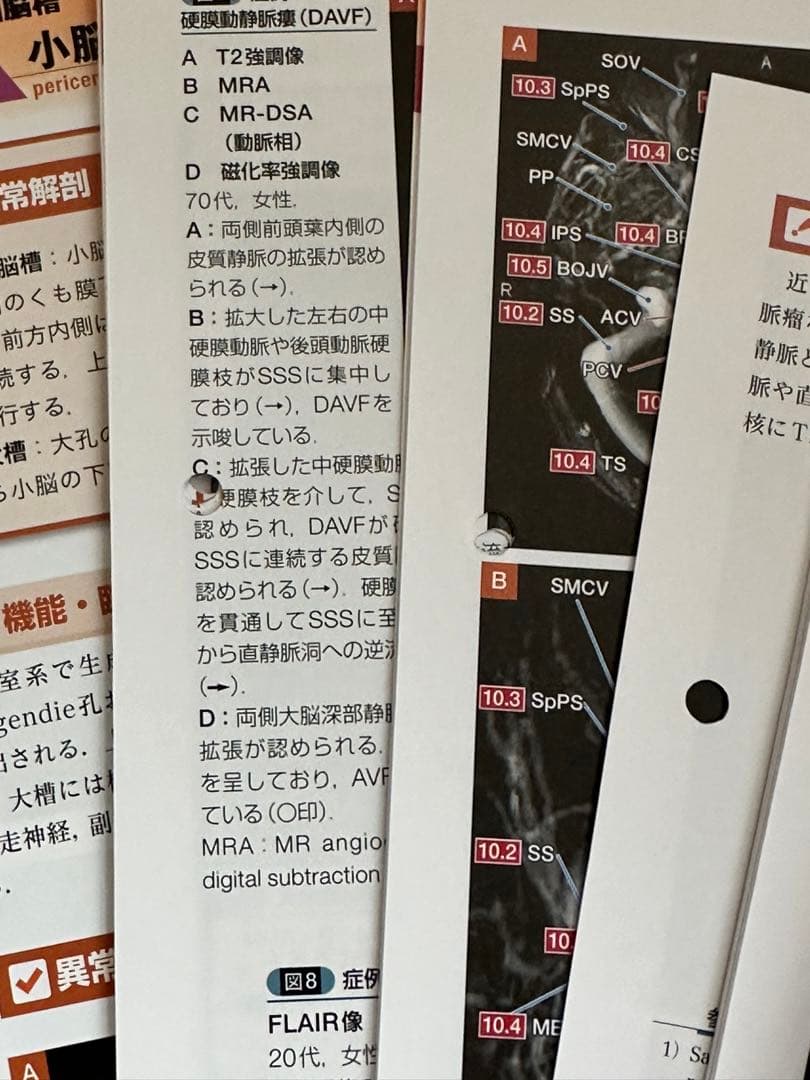 【裁断済】【2つ穴あり】脳神経画像解剖ナビゲーション