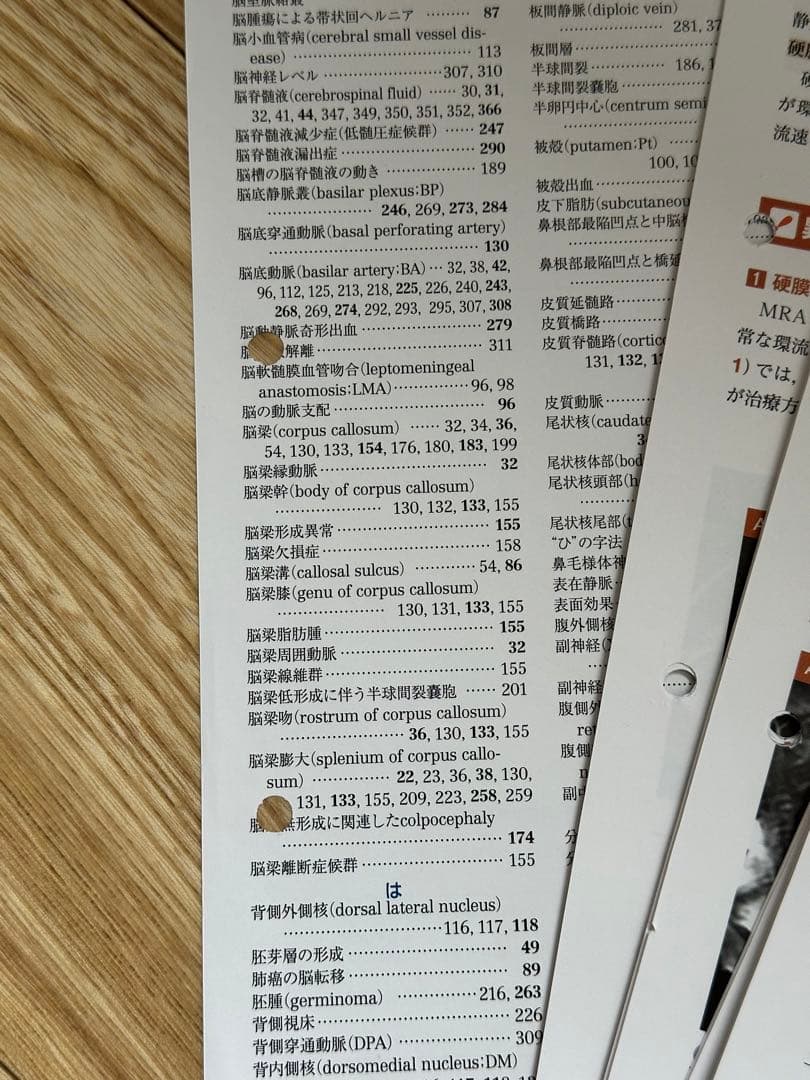 【裁断済】【2つ穴あり】脳神経画像解剖ナビゲーション