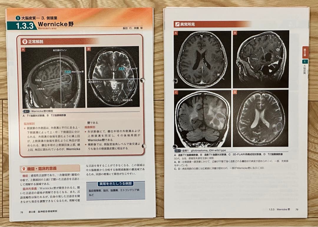【裁断済】【2つ穴あり】脳神経画像解剖ナビゲーション