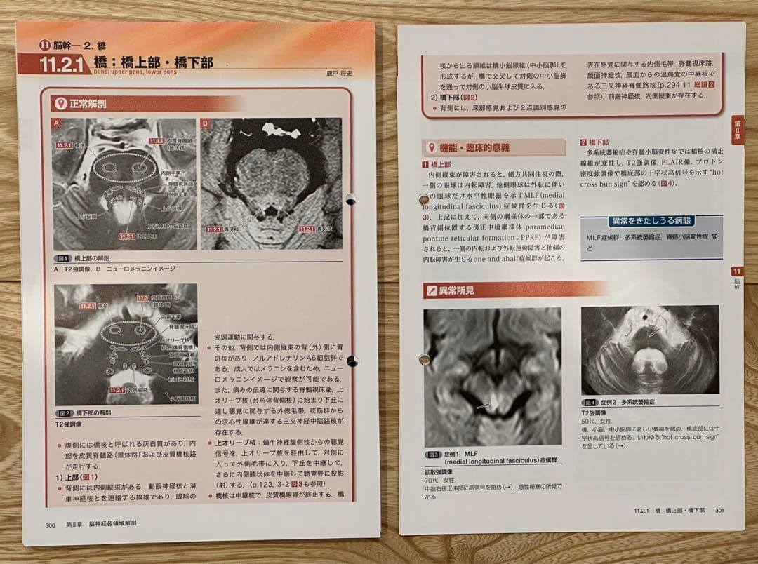 【裁断済】【2つ穴あり】脳神経画像解剖ナビゲーション