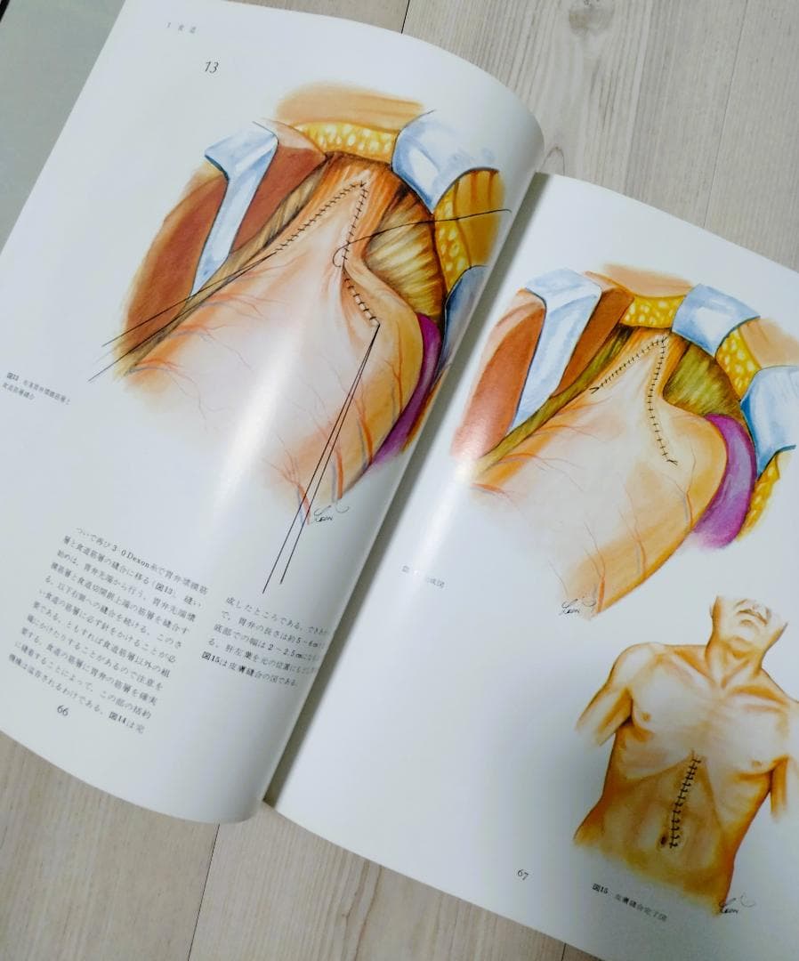【希少】消化器外科原色図譜 1
