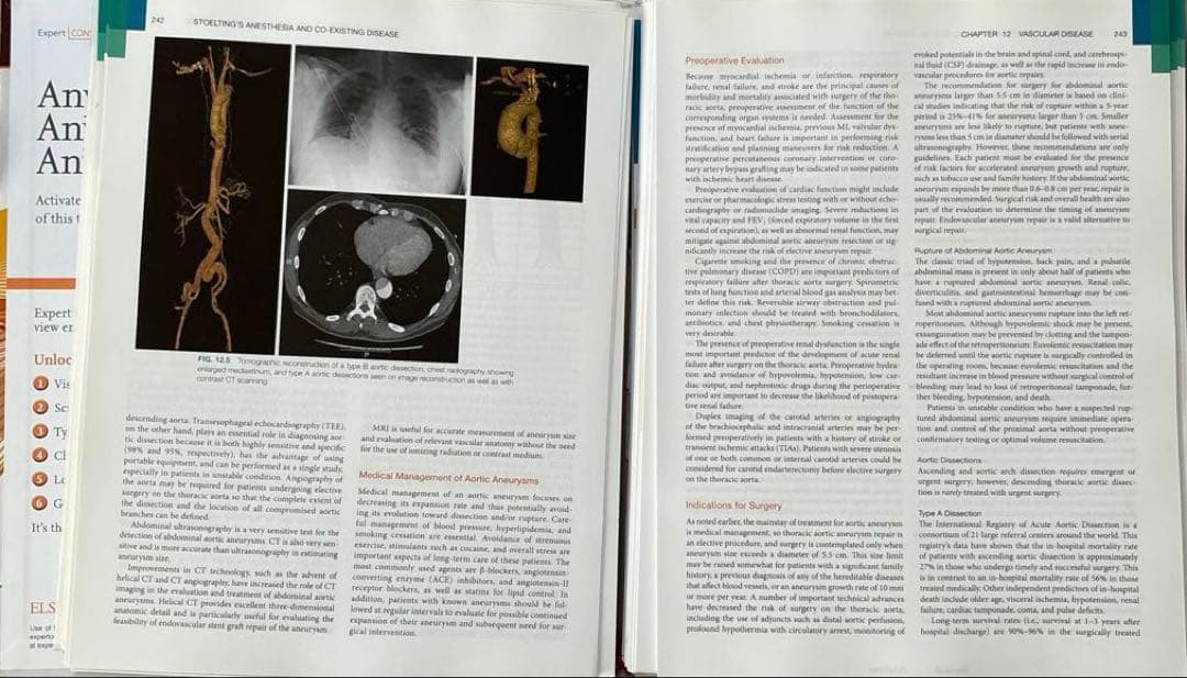 Anesthesia and Co-existing Disease 第7版