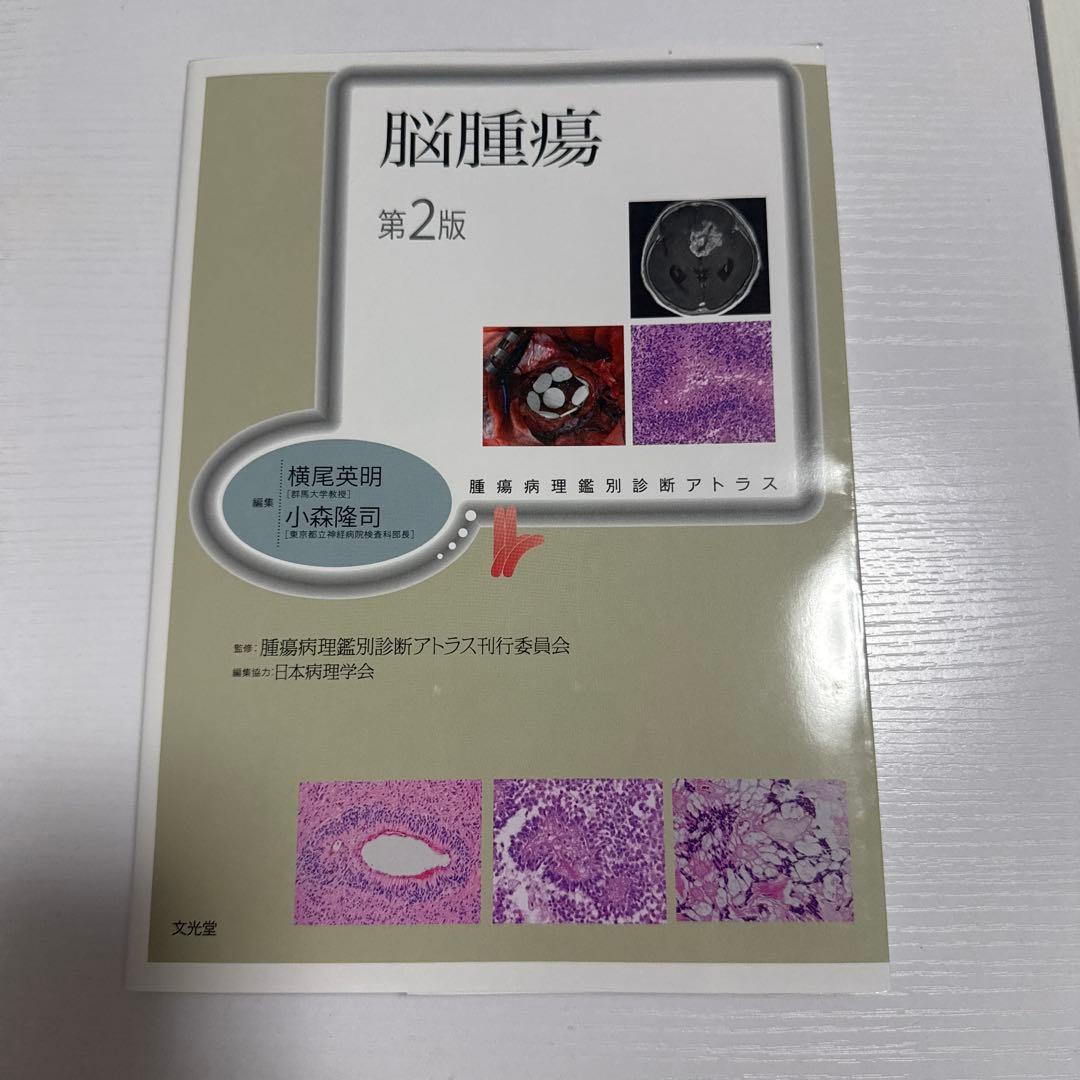 脳腫瘍