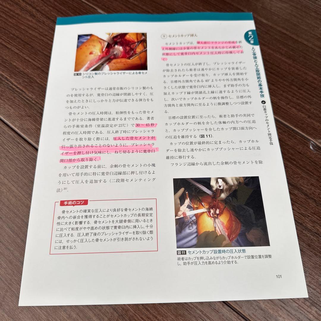 【※裁断済み】人工股関節置換術〈THA・BHA〉 人工関節の基礎知識