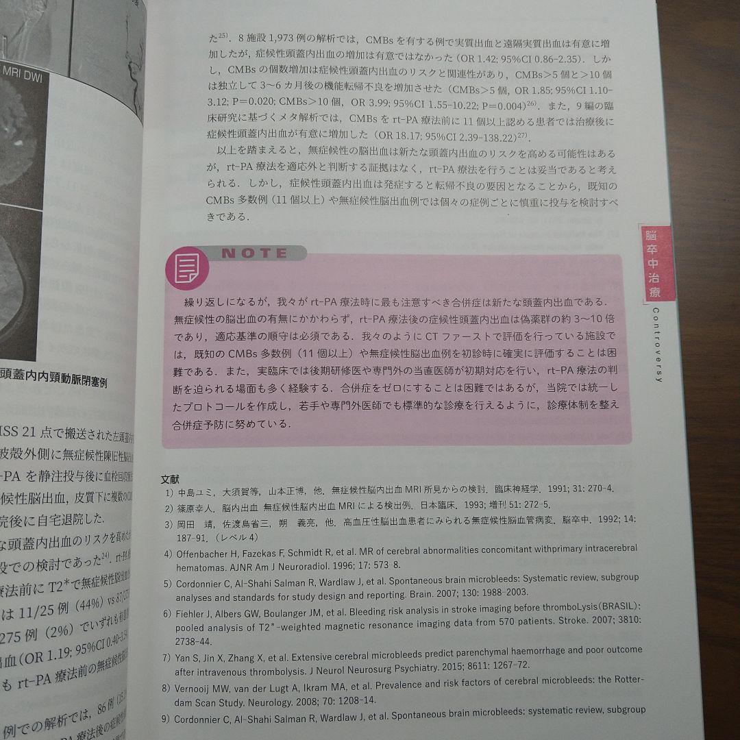 脳卒中治療 Controversy