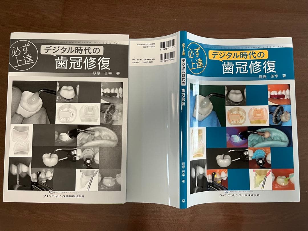 デジタル時代の歯冠修復【裁断済】