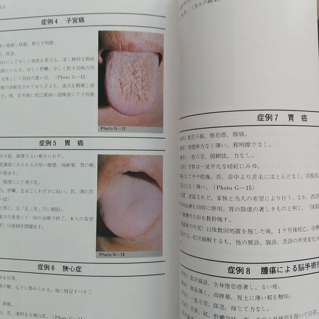 針灸舌診アトラス - 診断基礎と臨床の実際★藤本蓮風