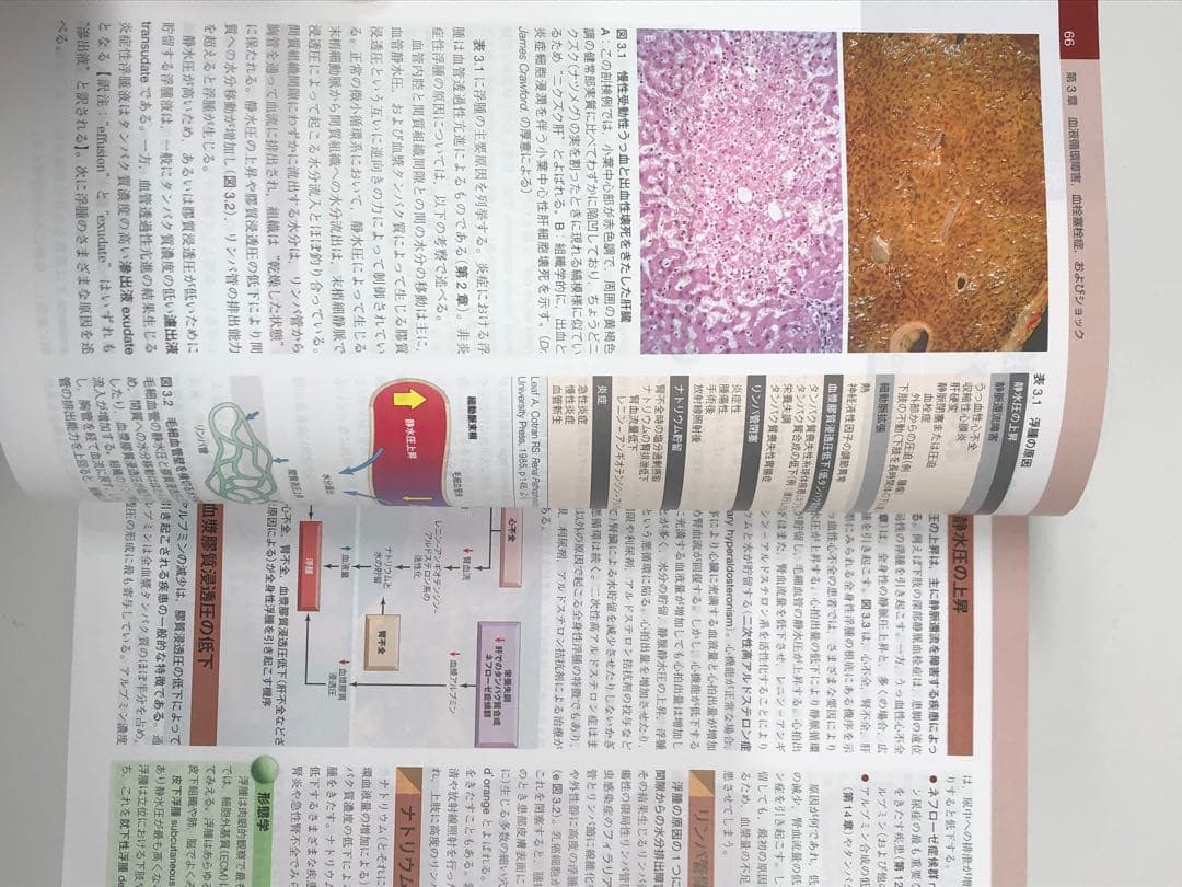 ロビンス基礎病理学　11版