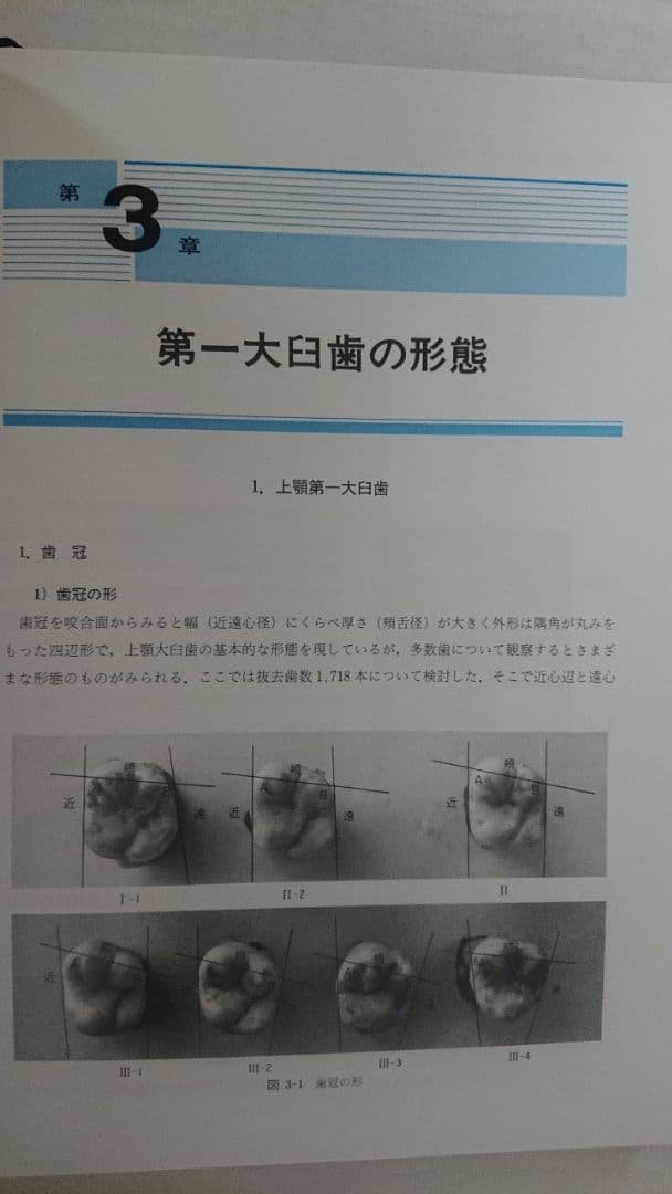 第一大臼歯