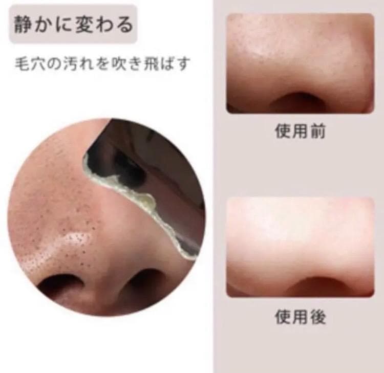 エステサロン同等2.4w回/秒の超音波振動❣自宅で毎日スペシャルケア♪❤美顔器