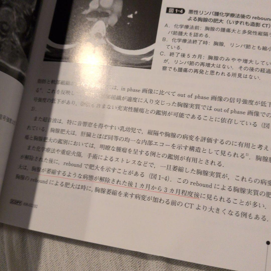 縦隔腫瘍の画像診断と病理