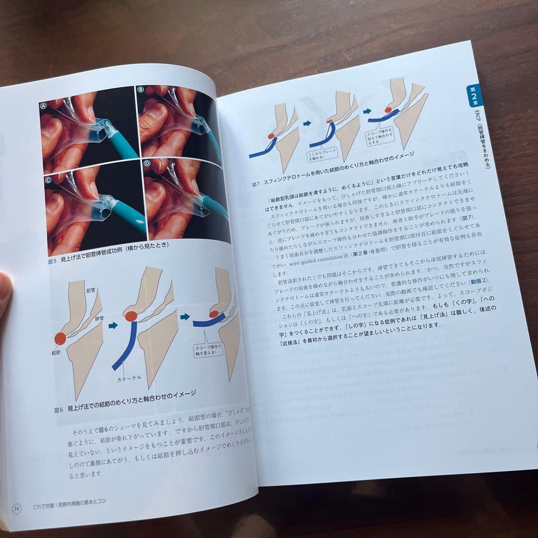 これで完璧！　胆膵内視鏡の基本とコツ