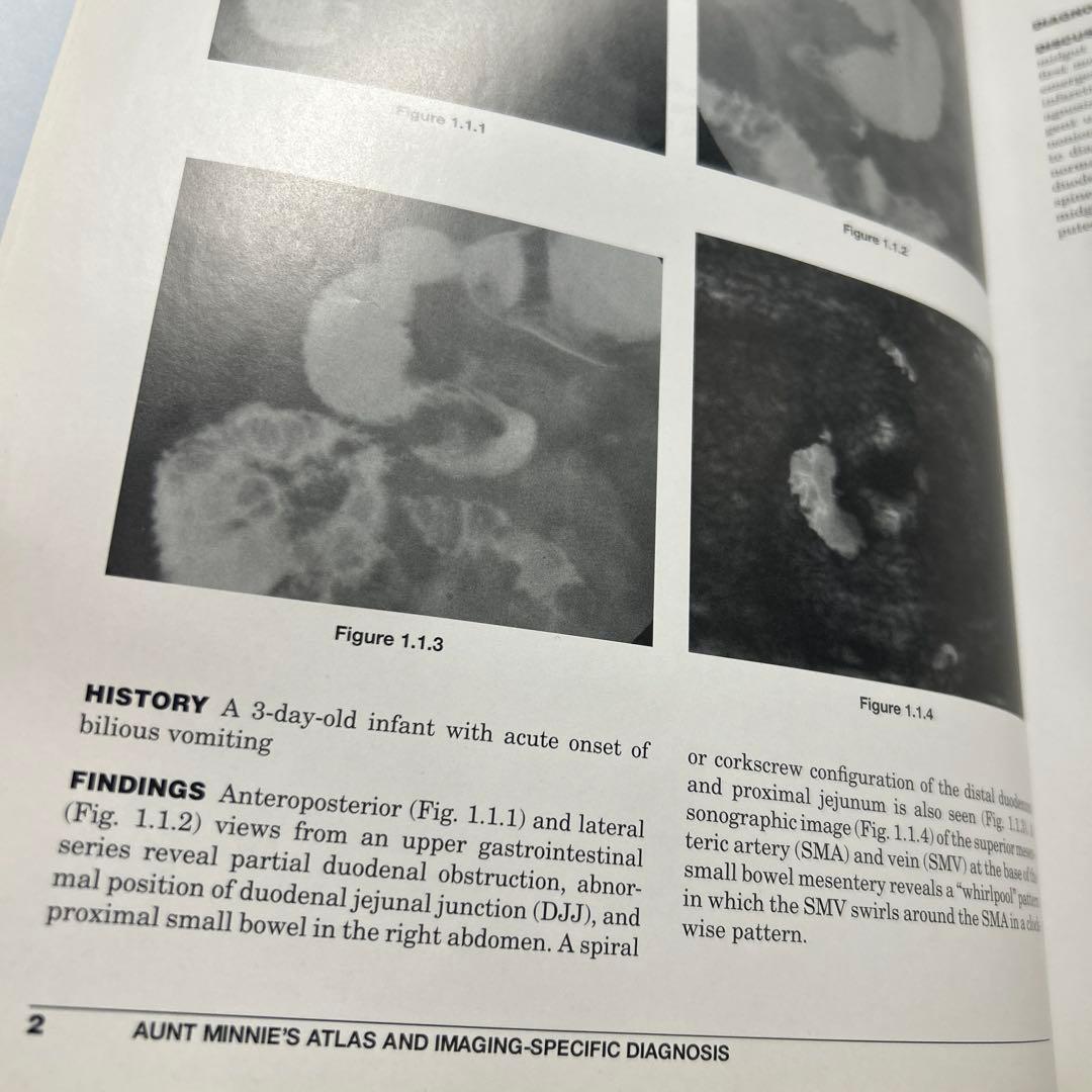 Aunt Minnie’s Atlas Imaging Diagnosis
