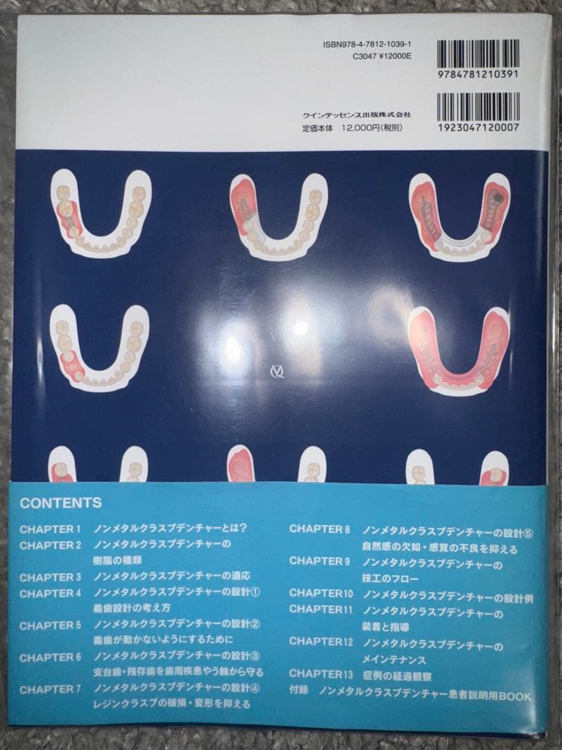 【裁断済み】ノンメタルクラスプデンチャー　増補新版