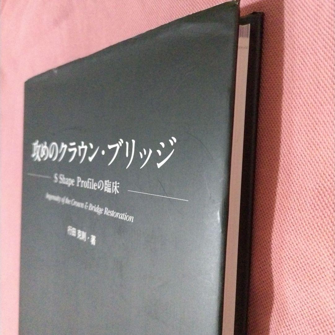 攻めのクラウン・ブリッジ = Ingenuity of the Crown &…