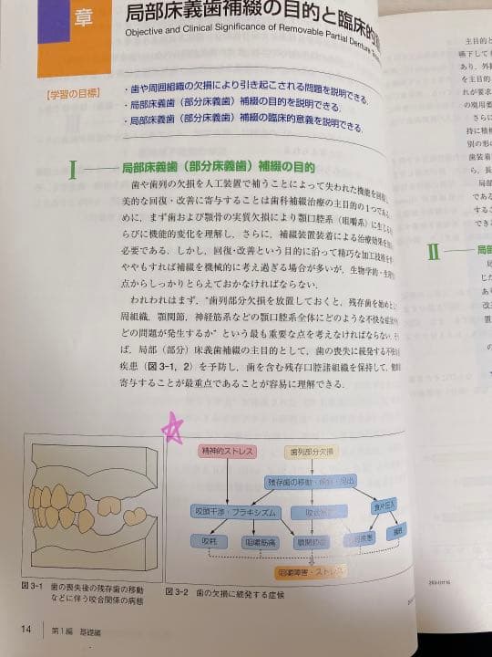 歯学生のパーシャルデンチャー