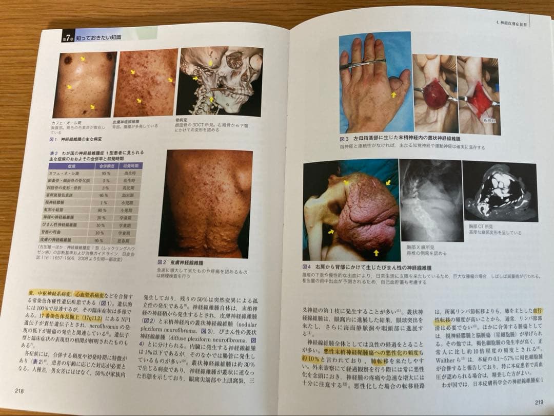 形成外科治療手技全書　5 腫瘍・母斑・血管奇形　　形成外科　皮膚科　医学書