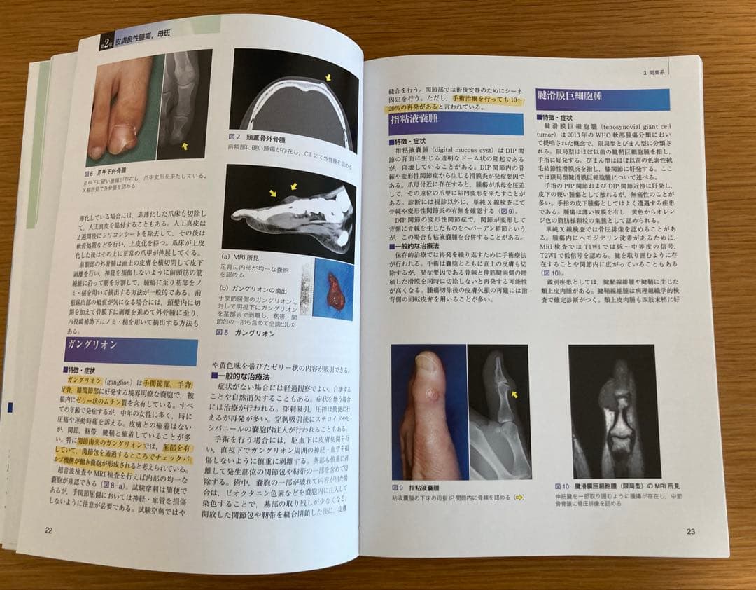 形成外科治療手技全書　5 腫瘍・母斑・血管奇形　　形成外科　皮膚科　医学書