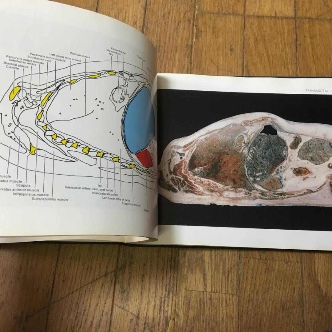 A color atlas of sectional anatomy医学洋書大型
