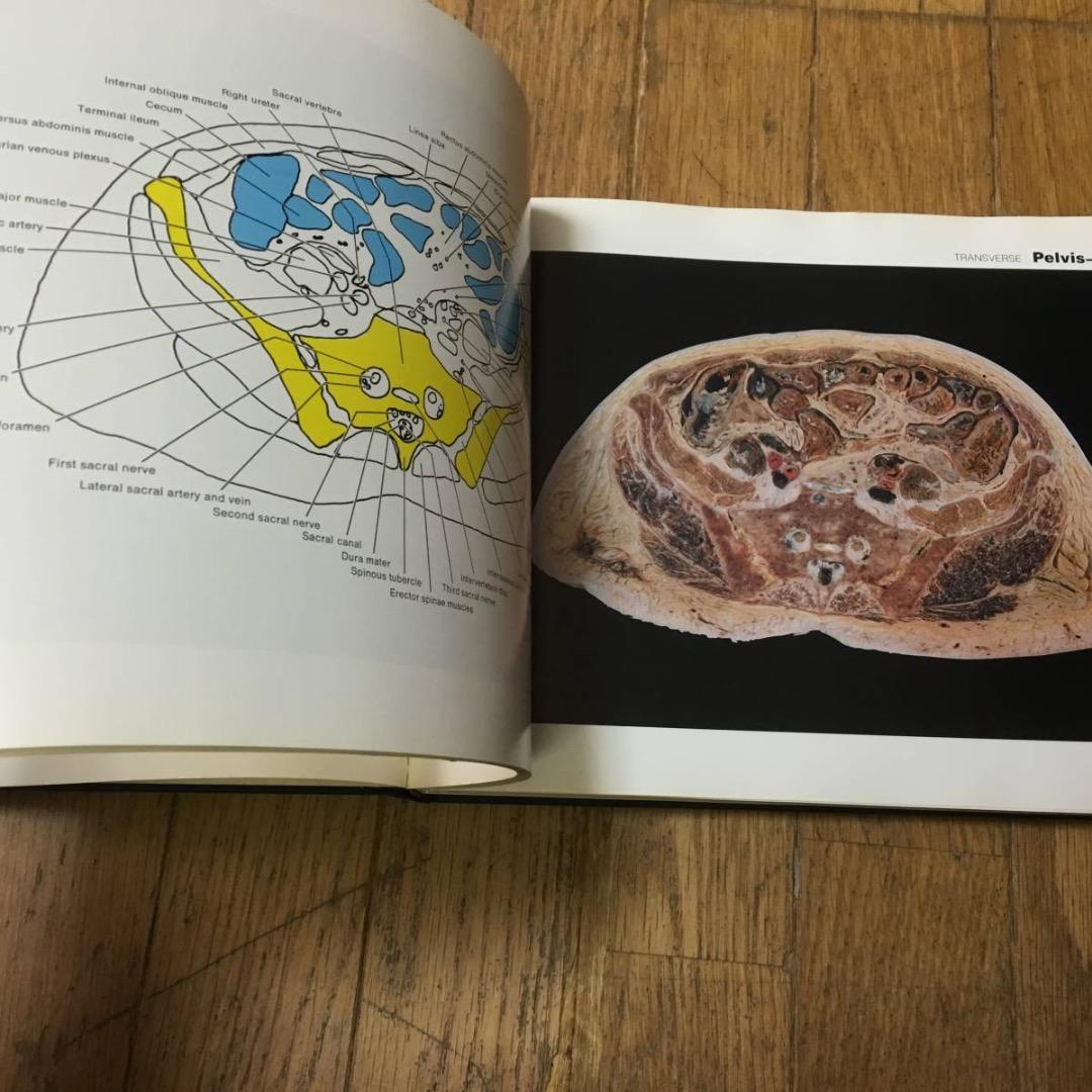 A color atlas of sectional anatomy医学洋書大型