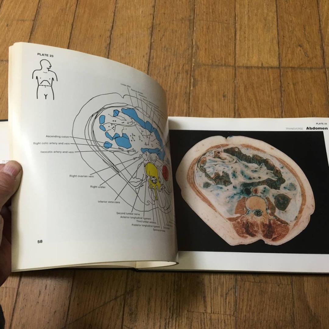 A color atlas of sectional anatomy医学洋書大型