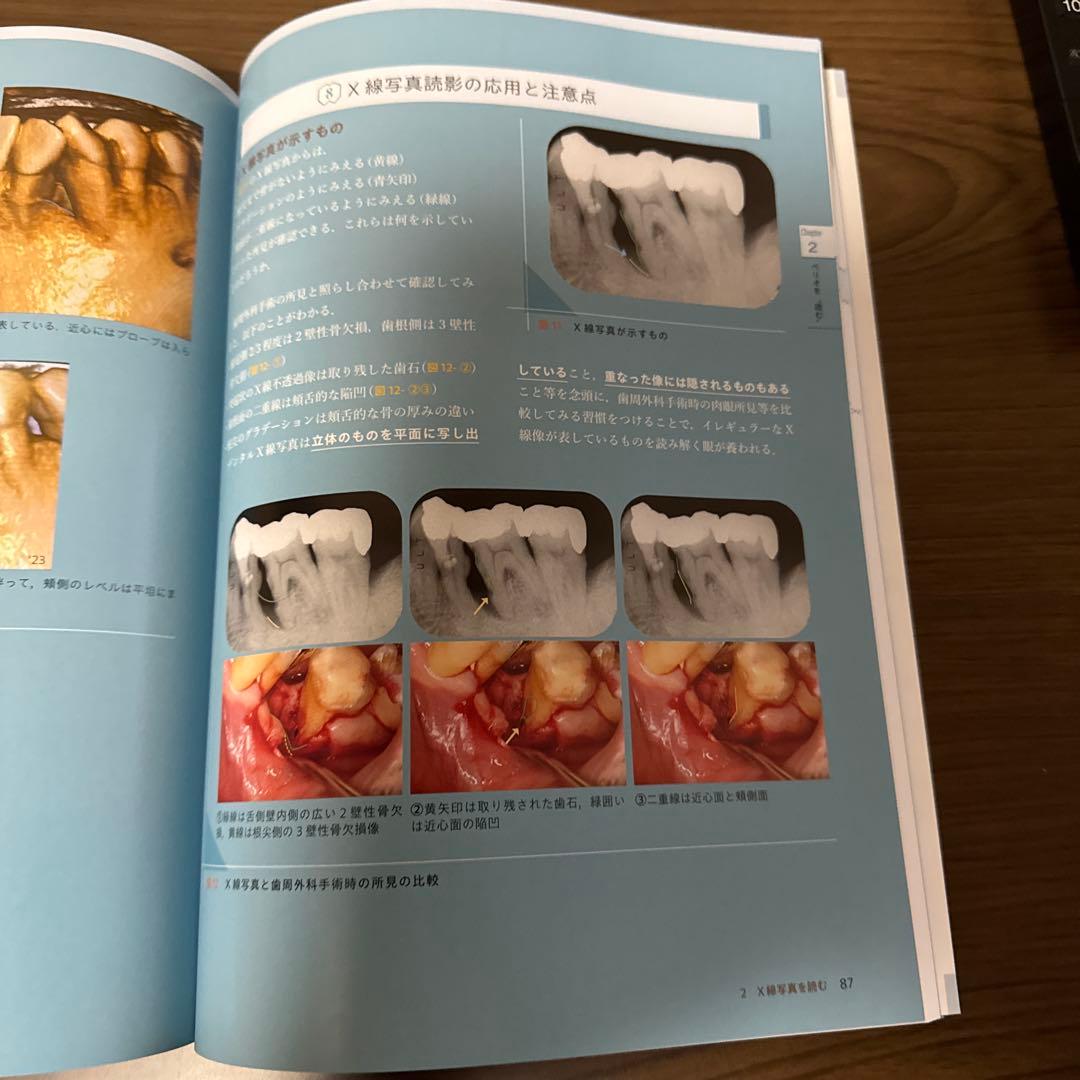 ペリオの治療形態と治し方